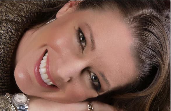 Shannon Motley smiling after porcelain veneers