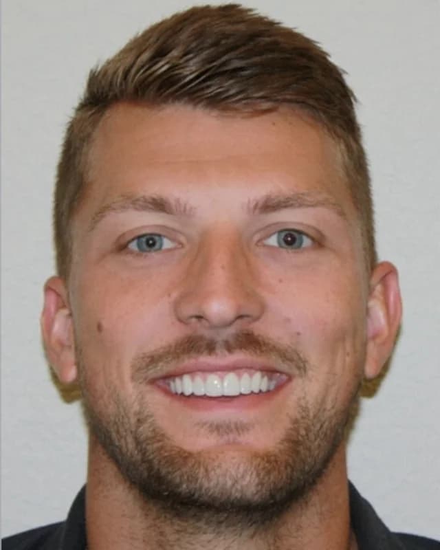 Skyler after porcelain veneers